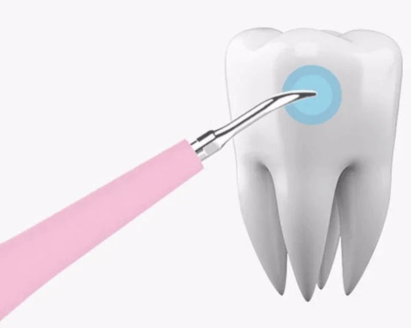 Why You Shouldn't Use Metal Electric Flossers: A Dental Safety Warning - SMILE-O