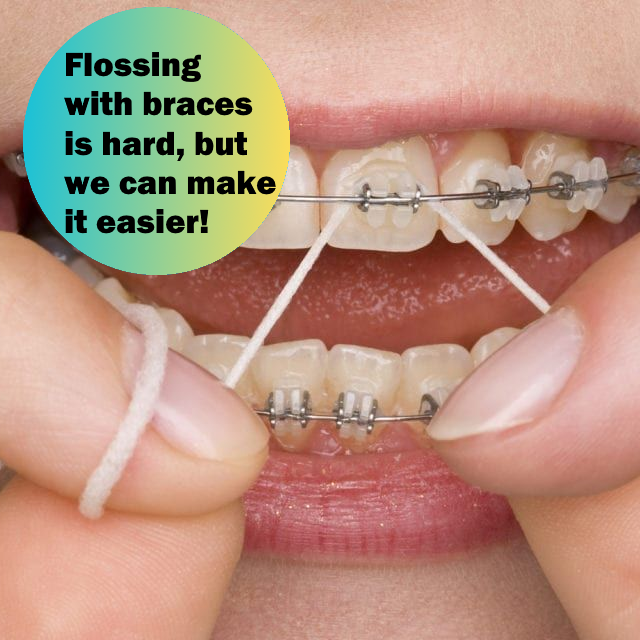 Smile-O AeroFloss Pro®